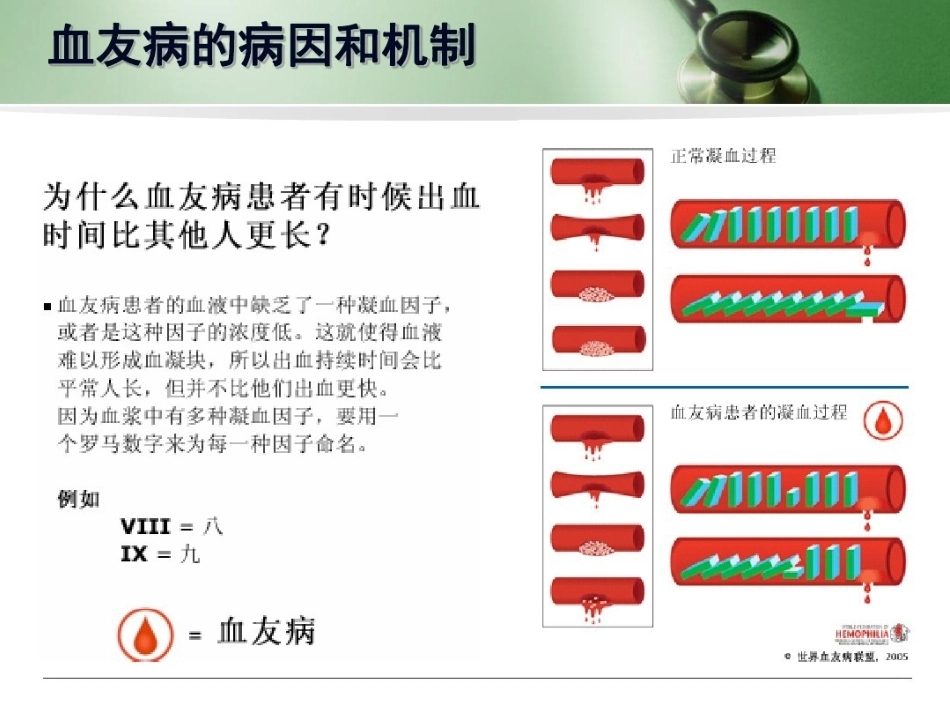 血友病 患者科普3_第3页