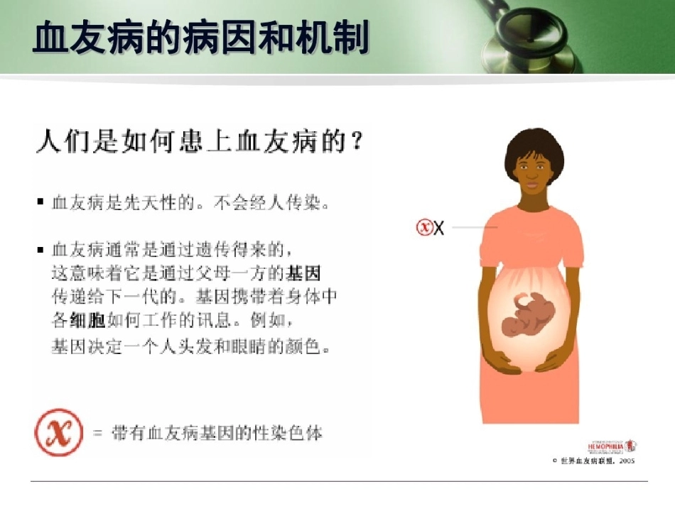 血友病 患者科普3_第4页