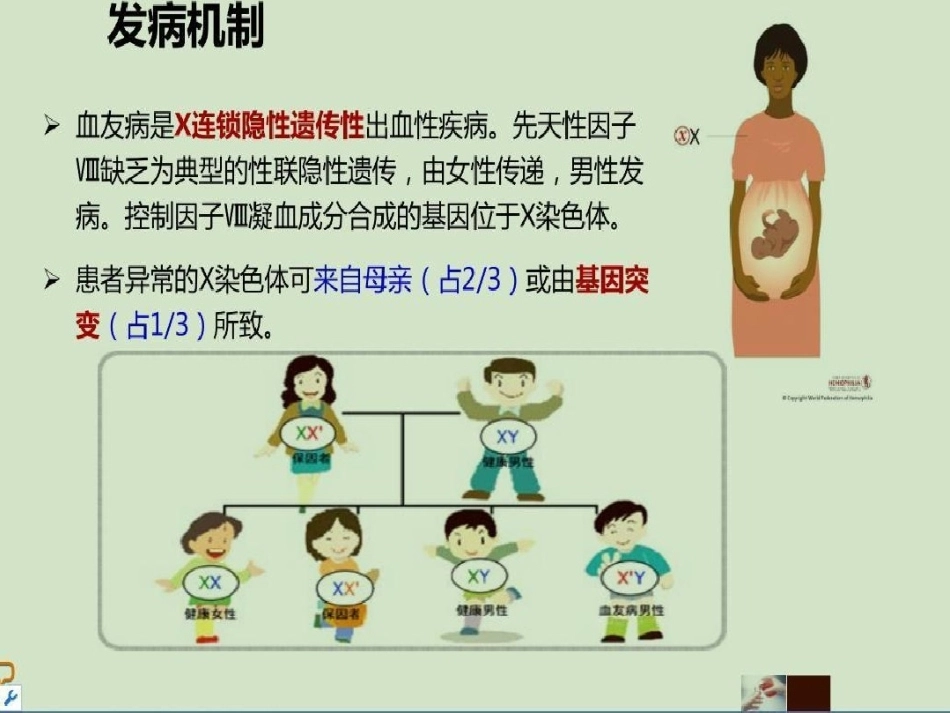 血友病 患者科普3_第5页