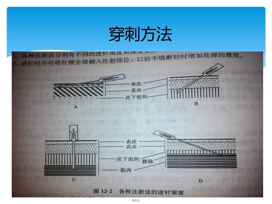 血友病的家庭治疗3_第5页