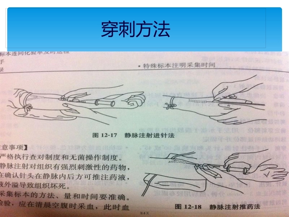 血友病的家庭治疗3_第6页