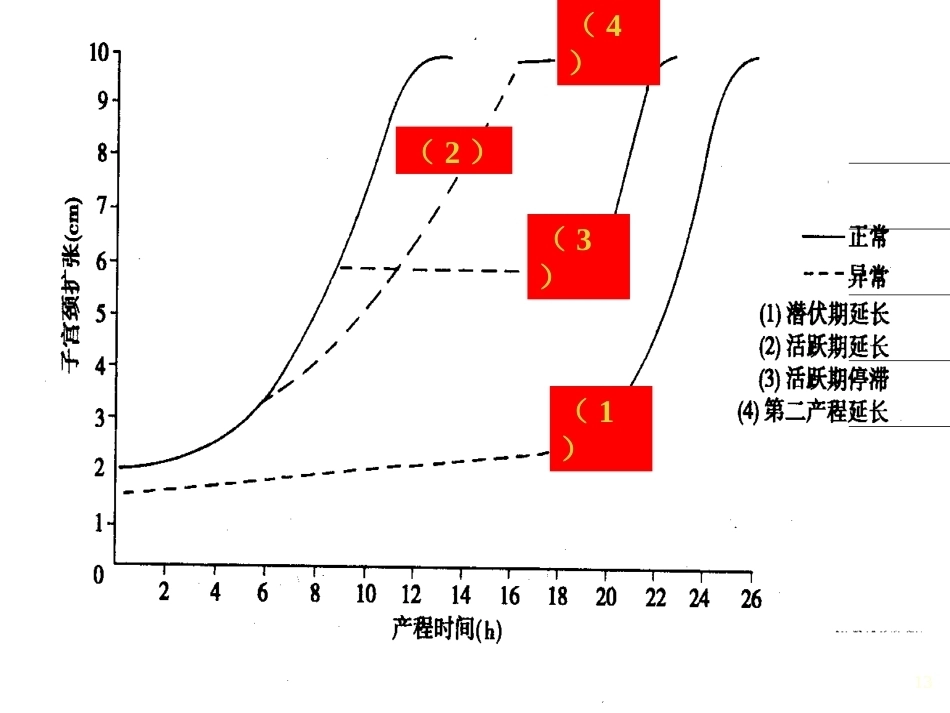 异常分娩的诊断与处理 ppt课件_第13页