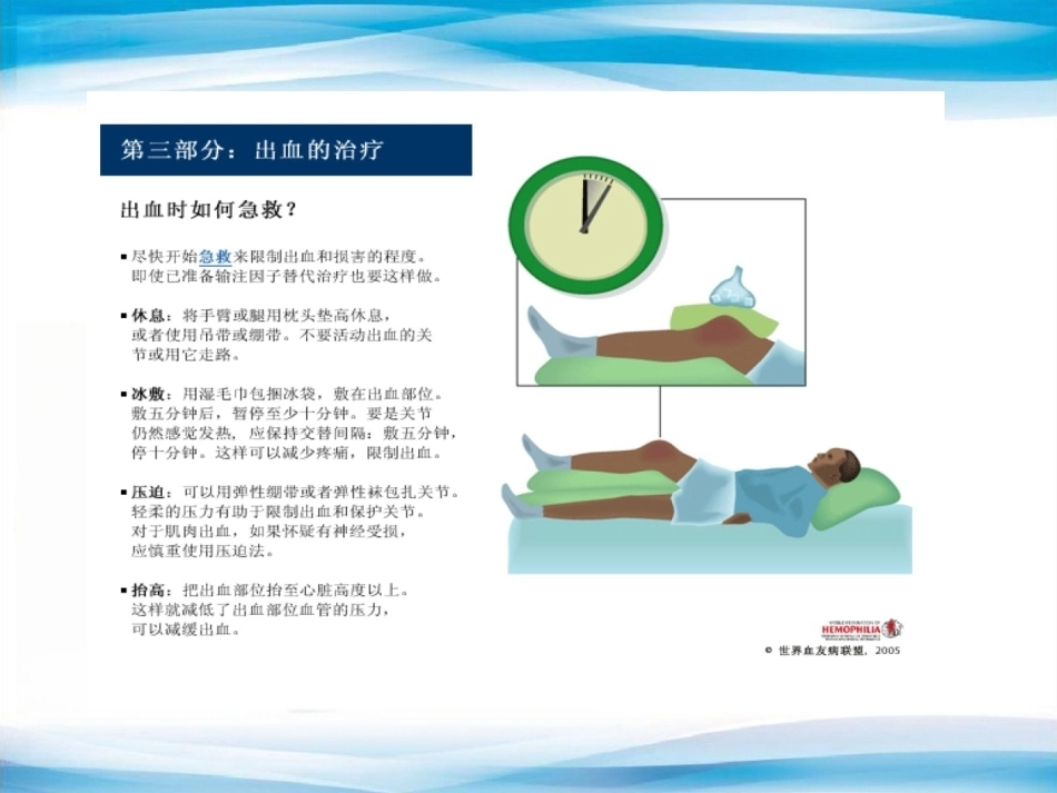 血友病的替代治疗5_第3页