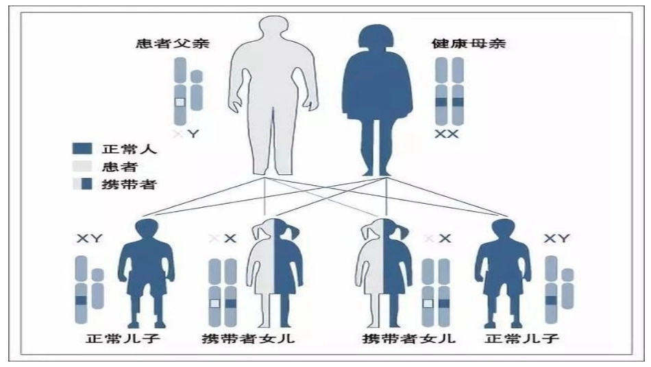 血友病8_第7页