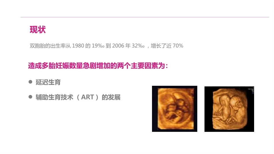 双胎妊娠的产前超声诊断_第2页