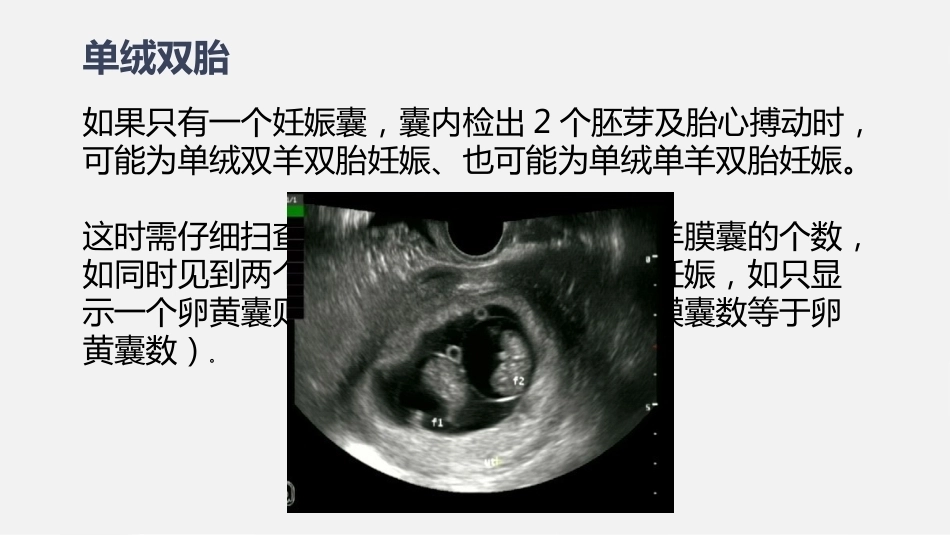 双胎妊娠超声诊断思路_第11页