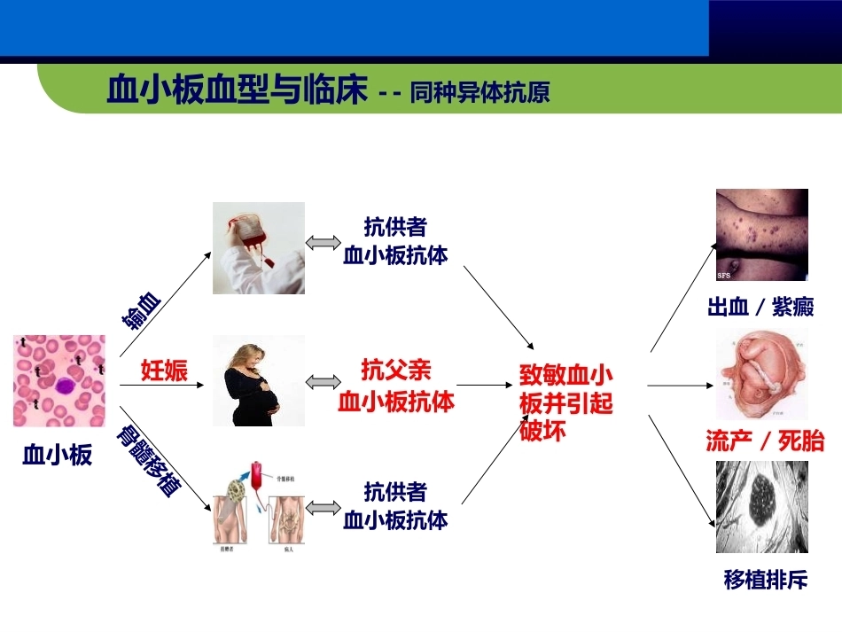 血小板抗体检测临床应用(妇产科篇)_第10页