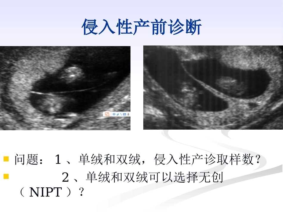 双胎妊娠的绒毛膜性超声诊断_第3页