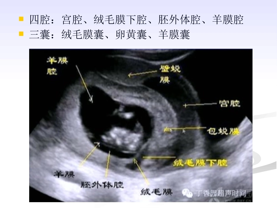 双胎妊娠的绒毛膜性超声诊断_第8页