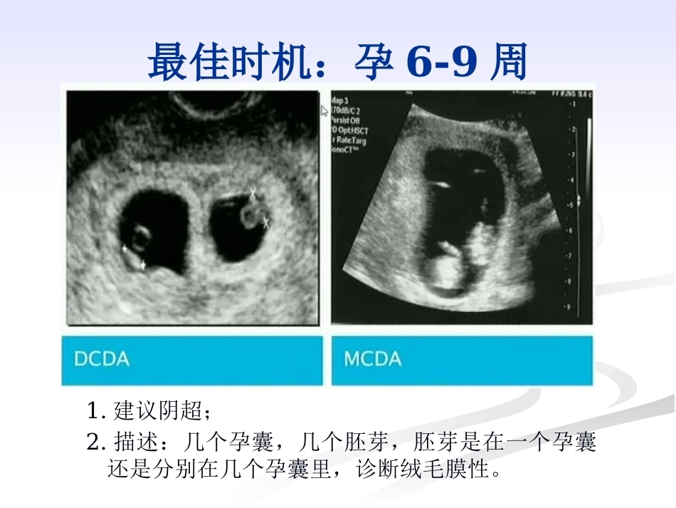 双胎妊娠的绒毛膜性超声诊断_第9页