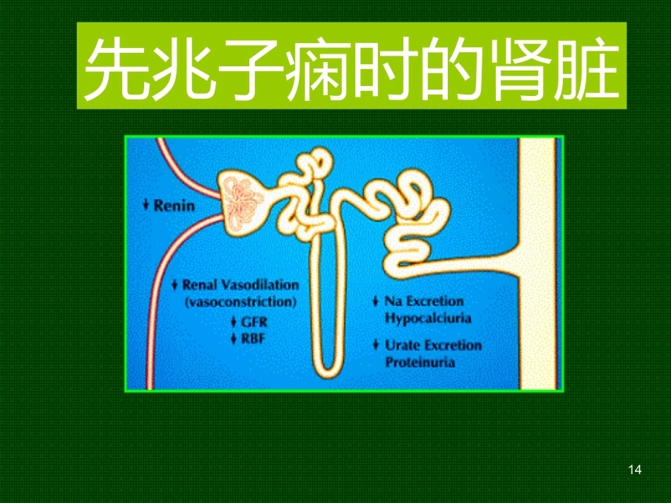 妊娠与肾脏疾病PPT课件_第14页