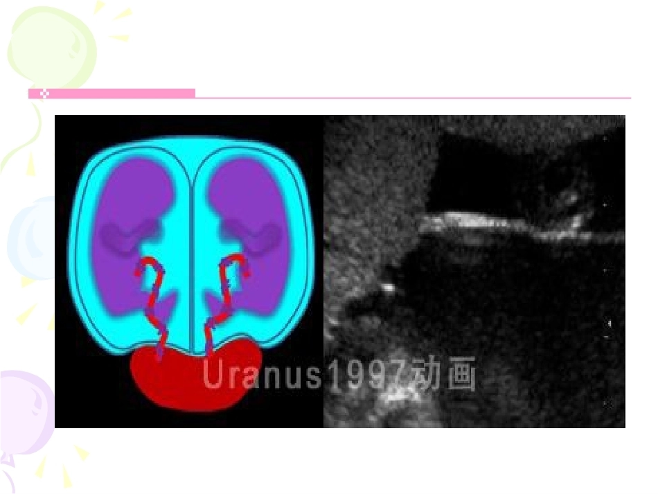 双胎妊娠最新版本_第12页