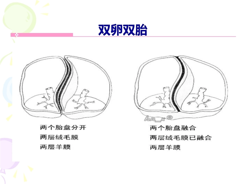 双胎妊娠最新版本_第4页