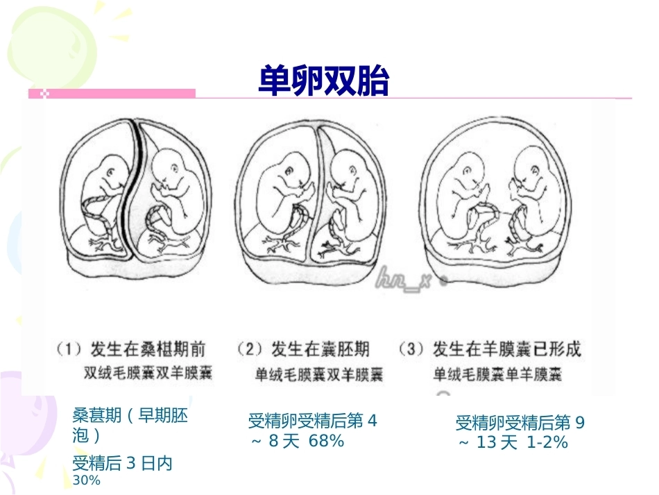 双胎妊娠最新版本_第5页