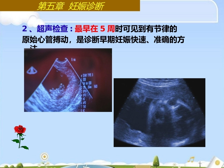 妊娠诊断最新_第11页
