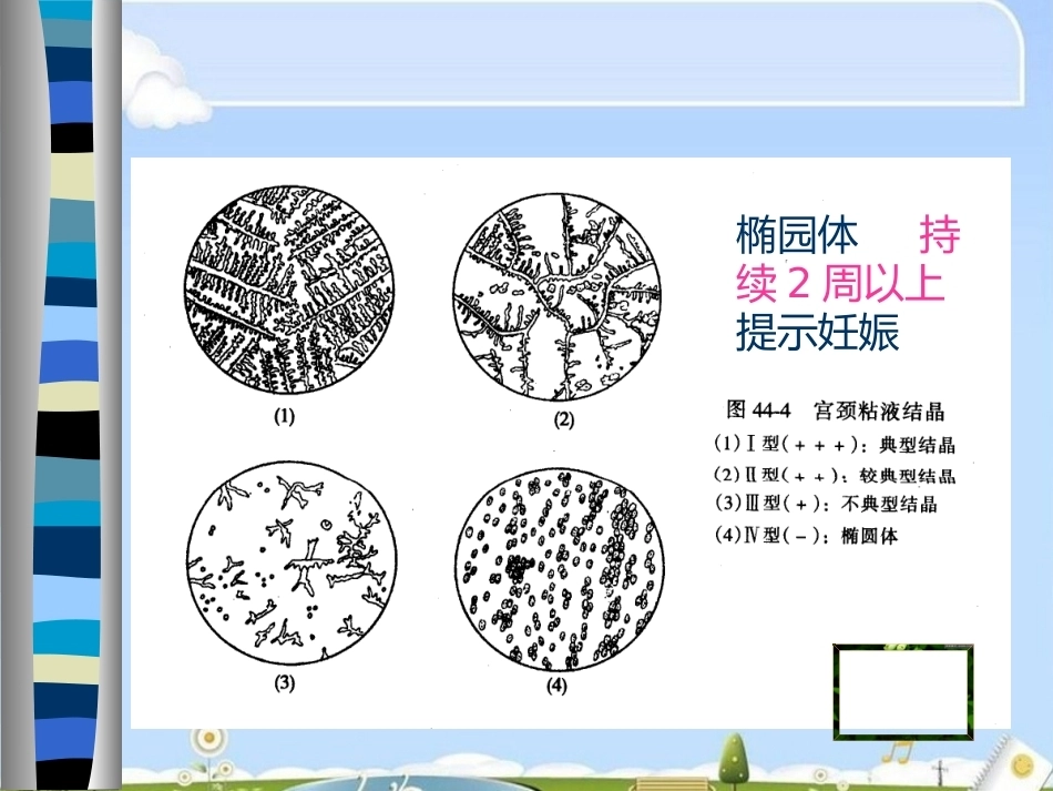 妊娠诊断最新_第15页