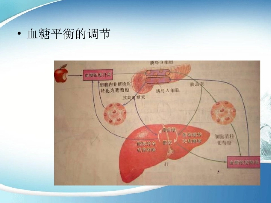 医学妊娠合并糖尿病_第4页