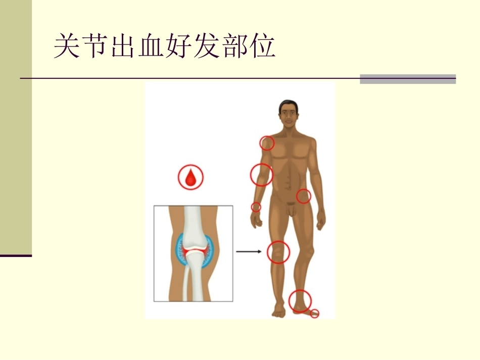 血友病护理技能_第7页