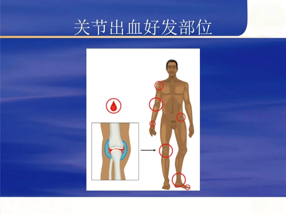 血友病护理技能-2_第7页