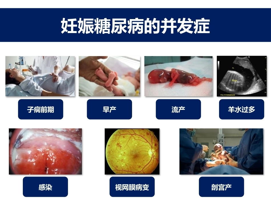 妊娠糖尿病的胰岛素治疗 医学_第15页