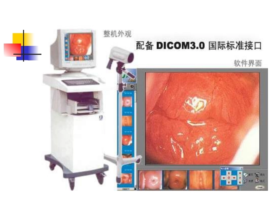 医用内窥镜在妇产科的应_第5页