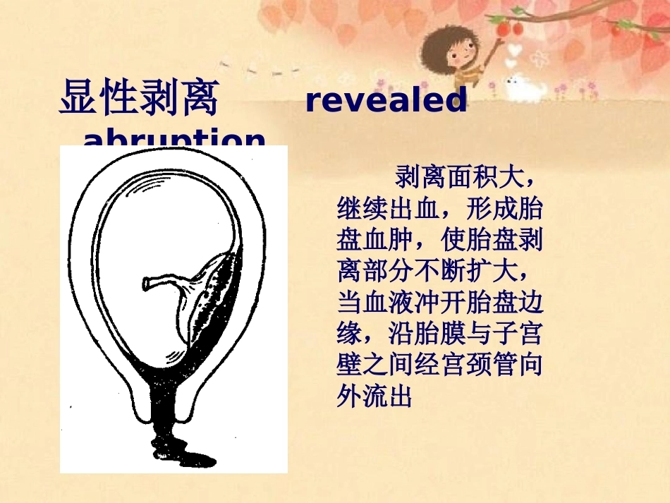 妊娠晚期出血_第10页