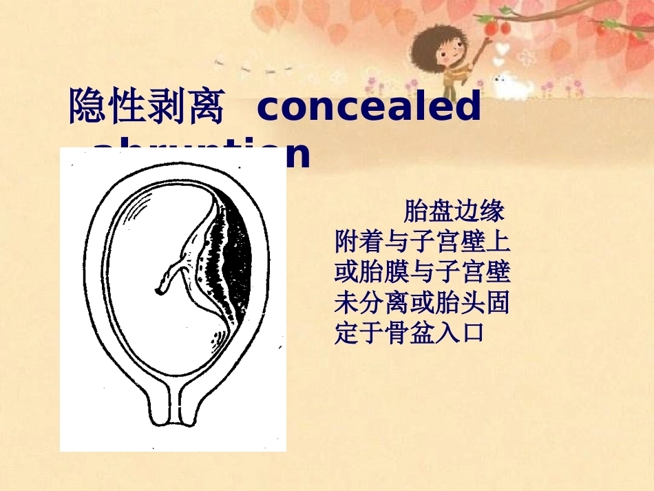 妊娠晚期出血_第11页