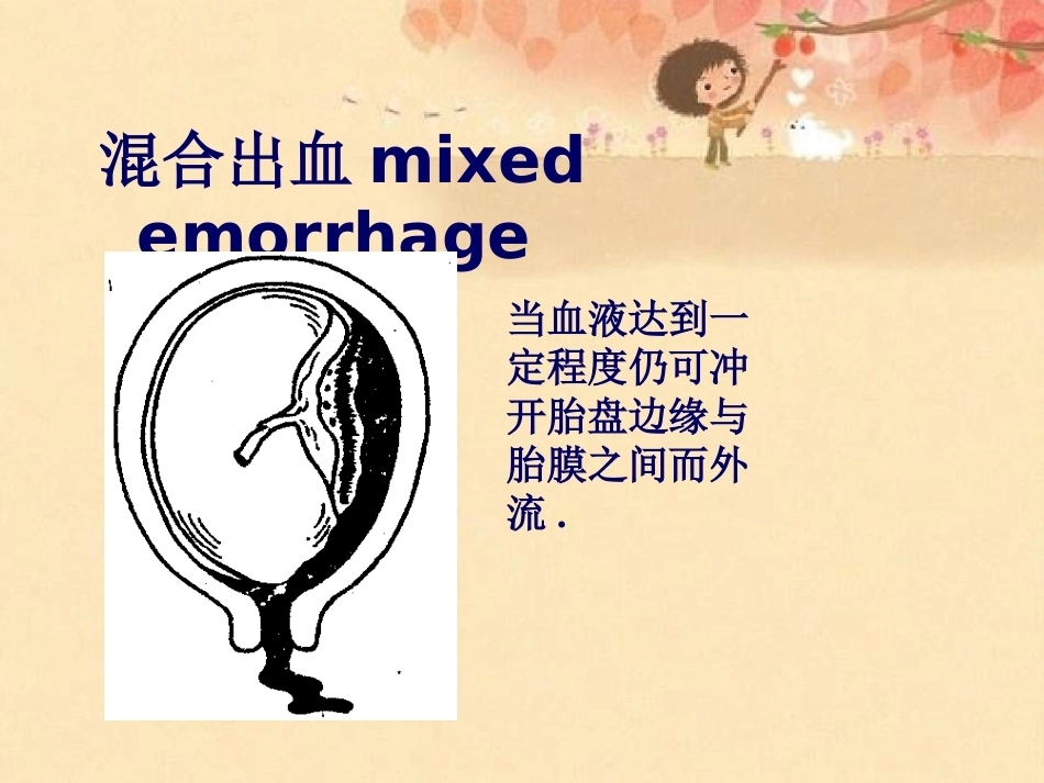 妊娠晚期出血_第12页