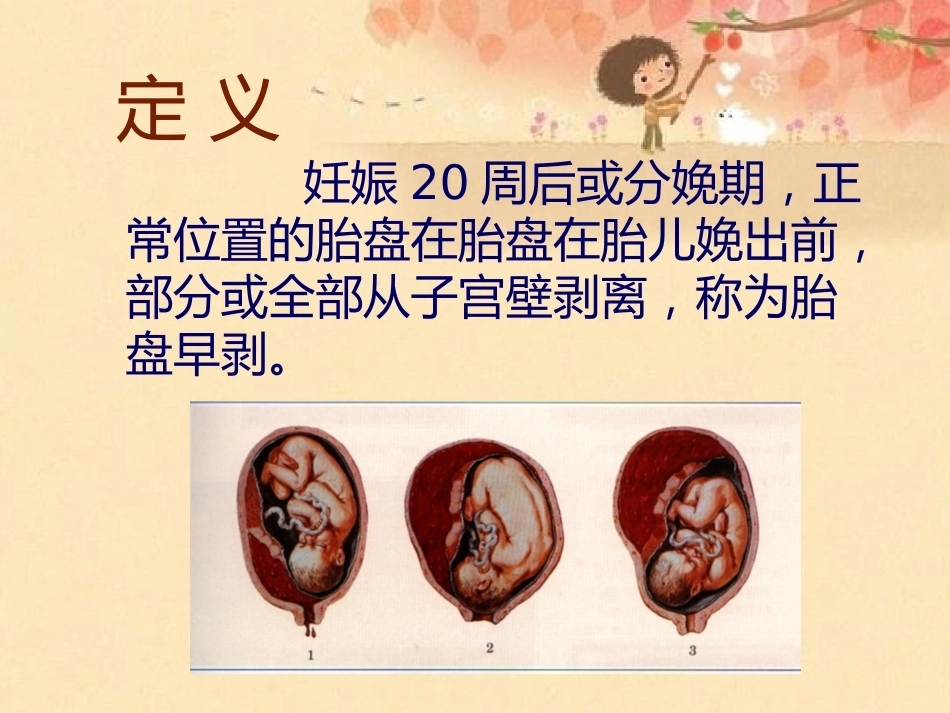 妊娠晚期出血_第5页