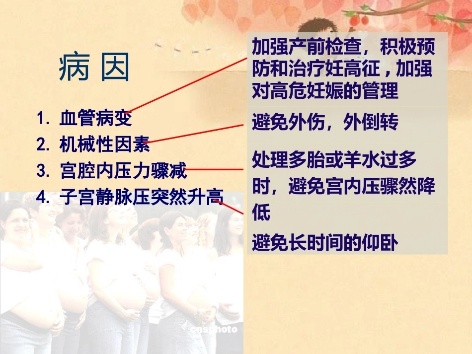 妊娠晚期出血_第6页