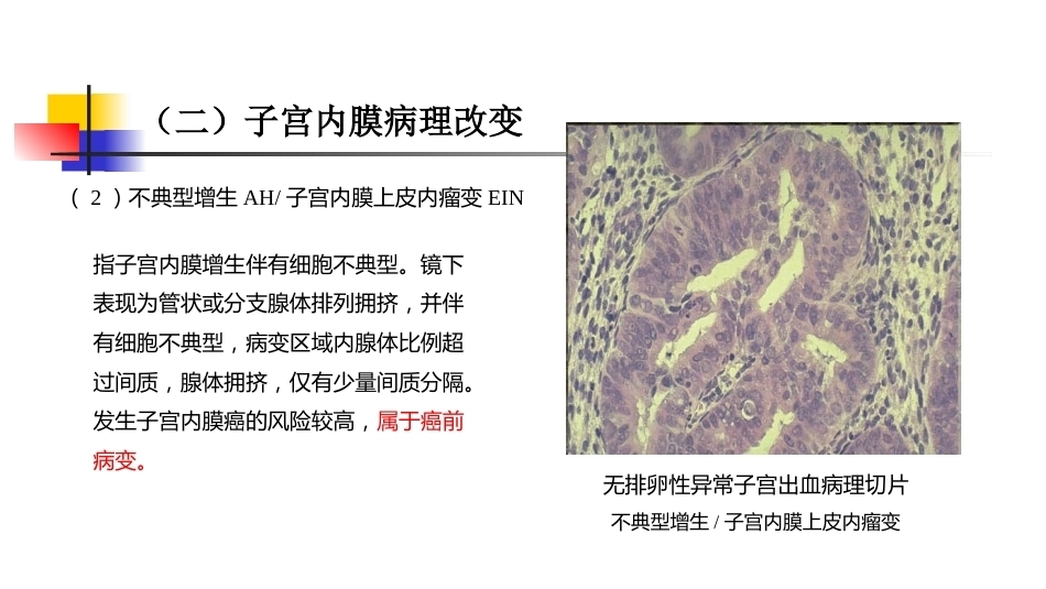 生殖内分泌系统 妇产科学_第10页