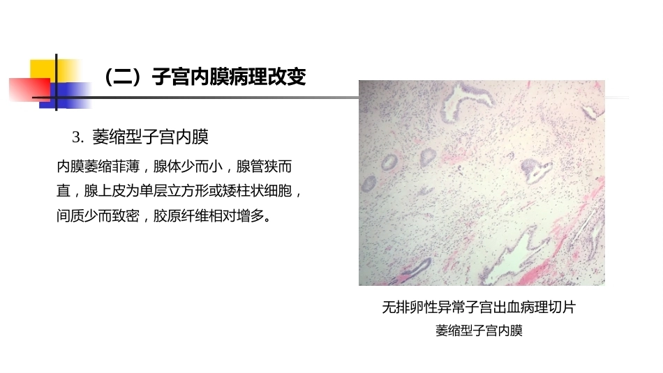 生殖内分泌系统 妇产科学_第11页