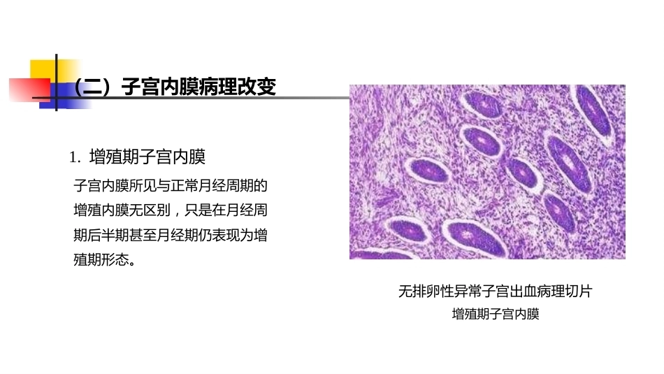 生殖内分泌系统 妇产科学_第8页