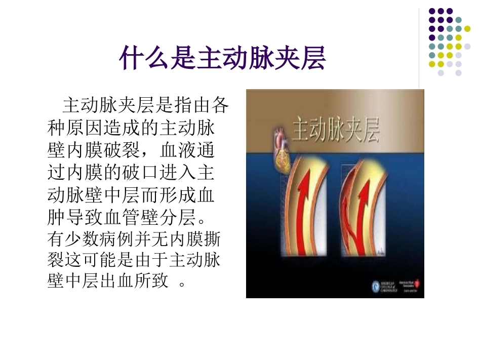 妊娠遇到主动脉夹_第6页