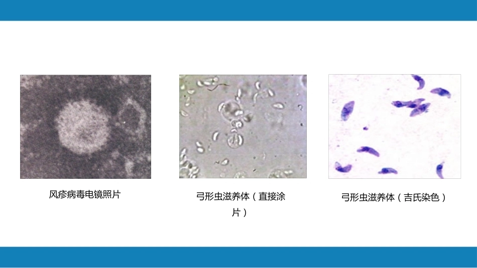 妊娠相关感染疾病_第4页