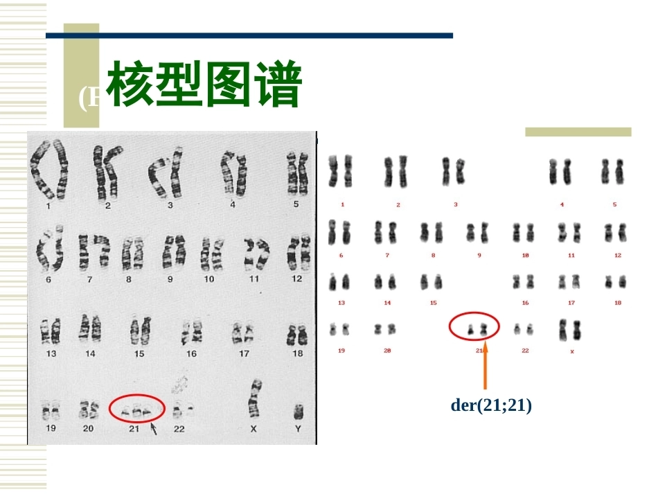 唐氏产前筛查_第3页