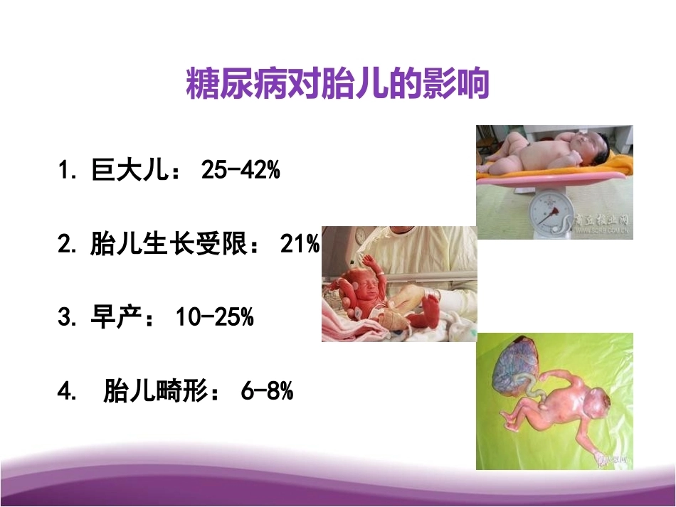 妊娠期糖尿病及自我管理_第10页
