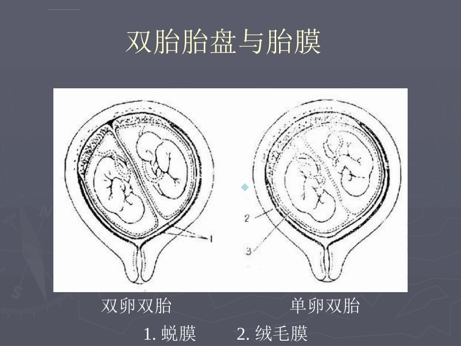 医学ppt课件多胎妊娠_第7页