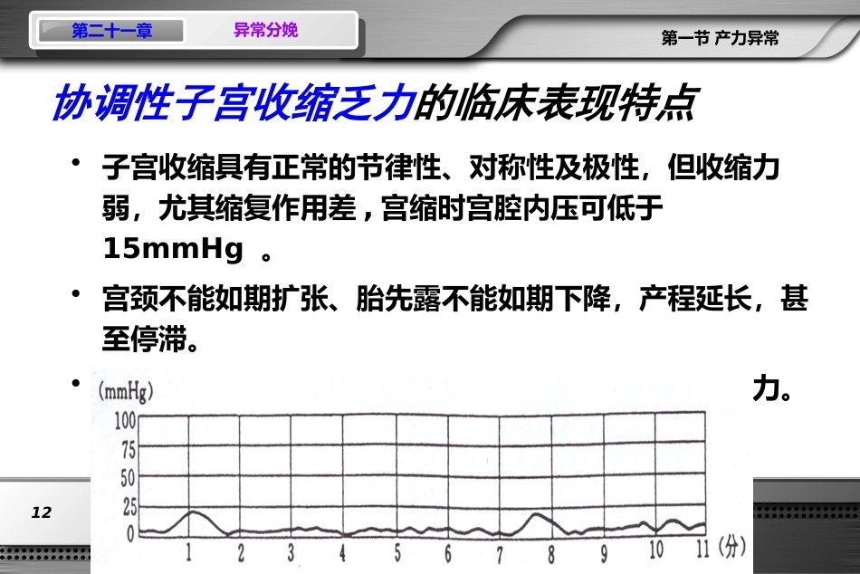 异常分娩(难产)PPT课件_第12页