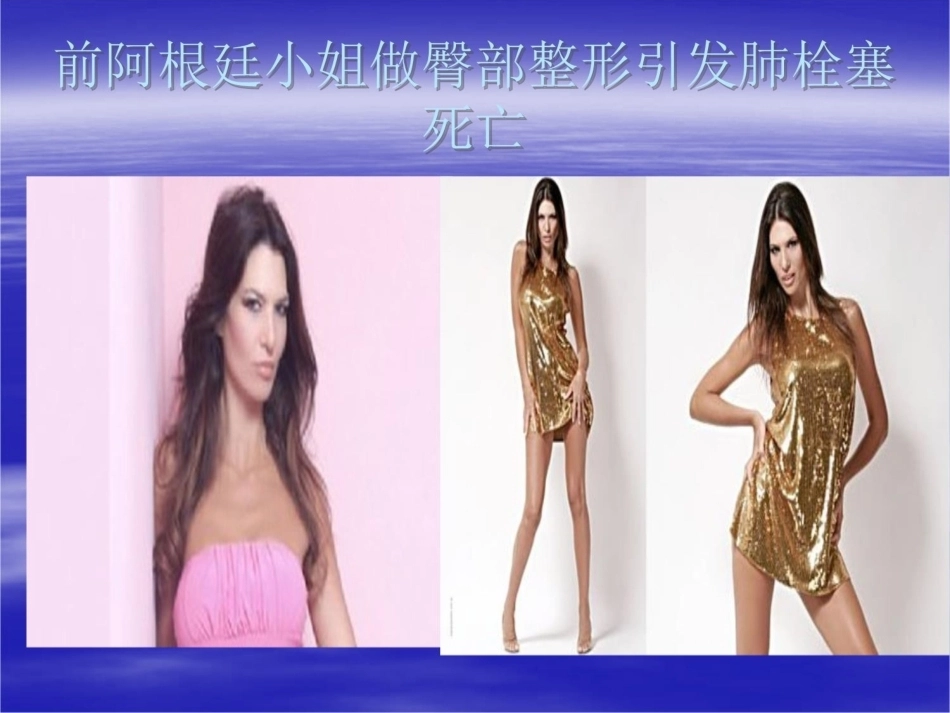 围产期肺栓塞2_第4页