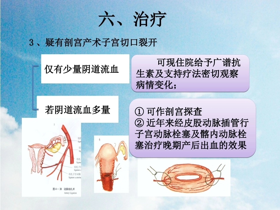晚期产后出血2_第12页