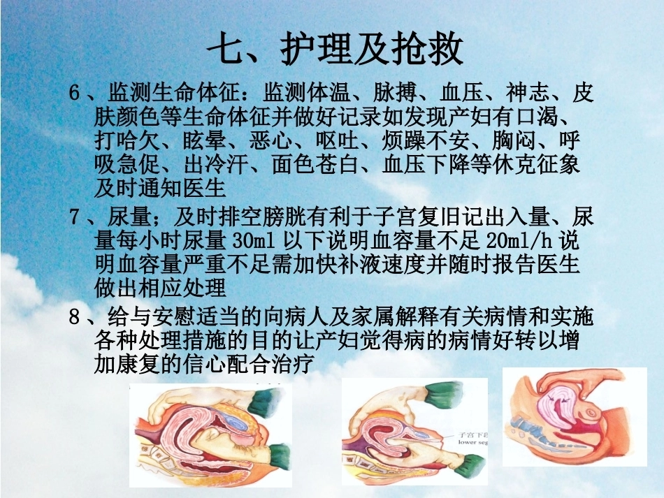 晚期产后出血2_第15页