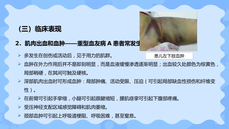 小儿血友病_第10页
