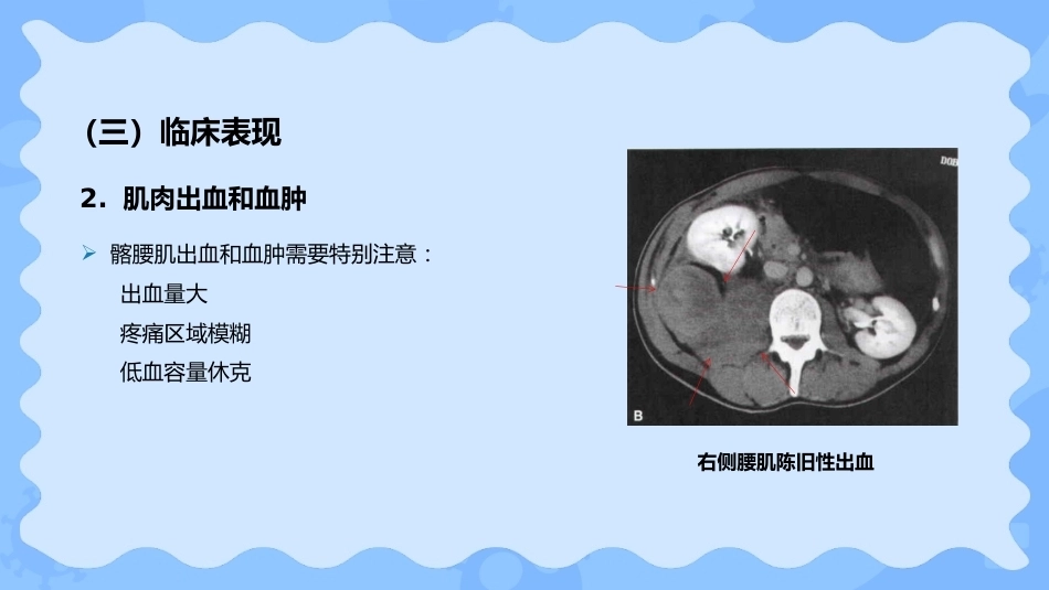 小儿血友病_第11页