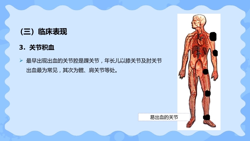 小儿血友病_第12页