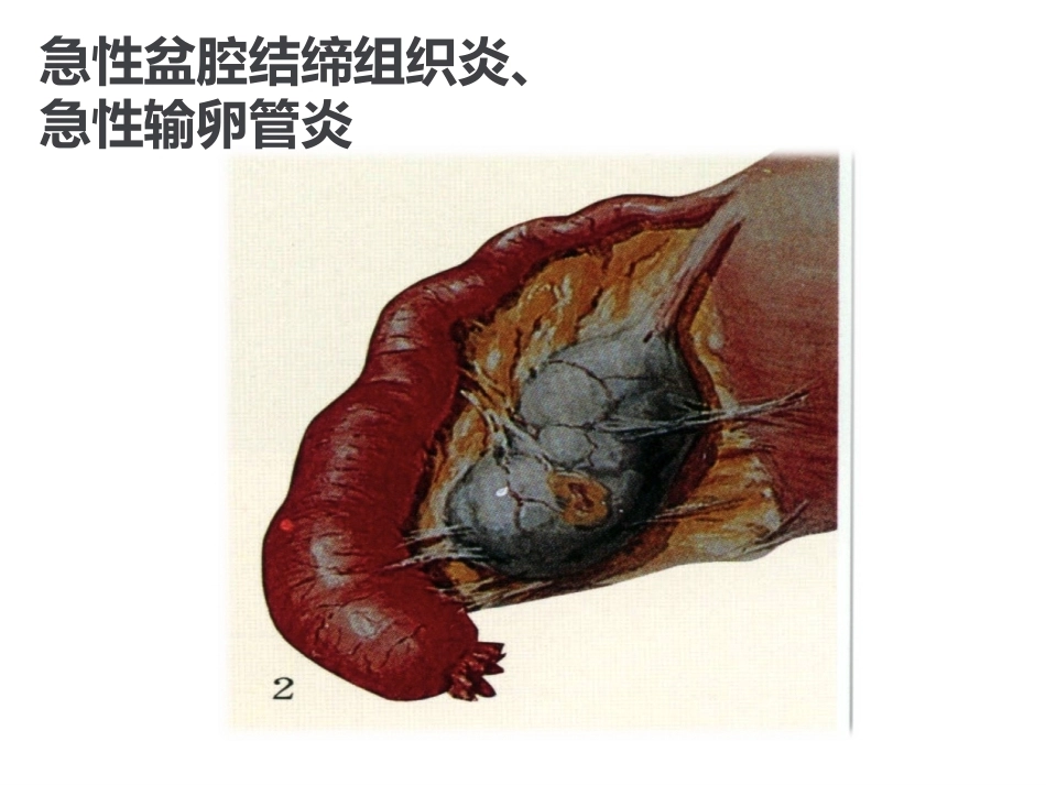 异常产褥妇产科学2_第10页