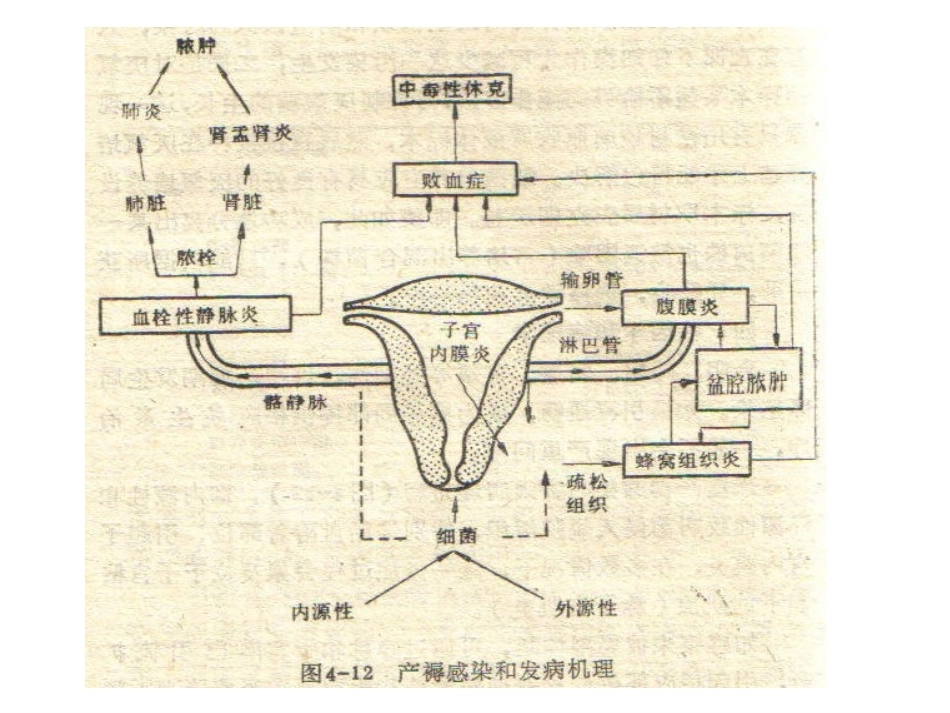 异常产褥妇产科学2_第8页