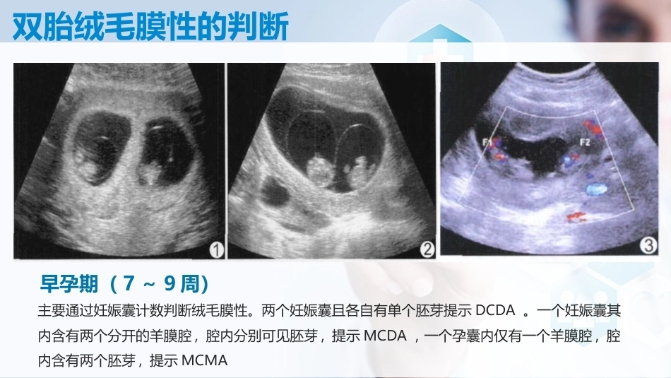 双胎妊娠孕期管理_第4页