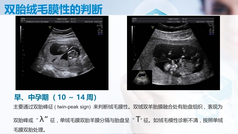 双胎妊娠孕期管理_第5页
