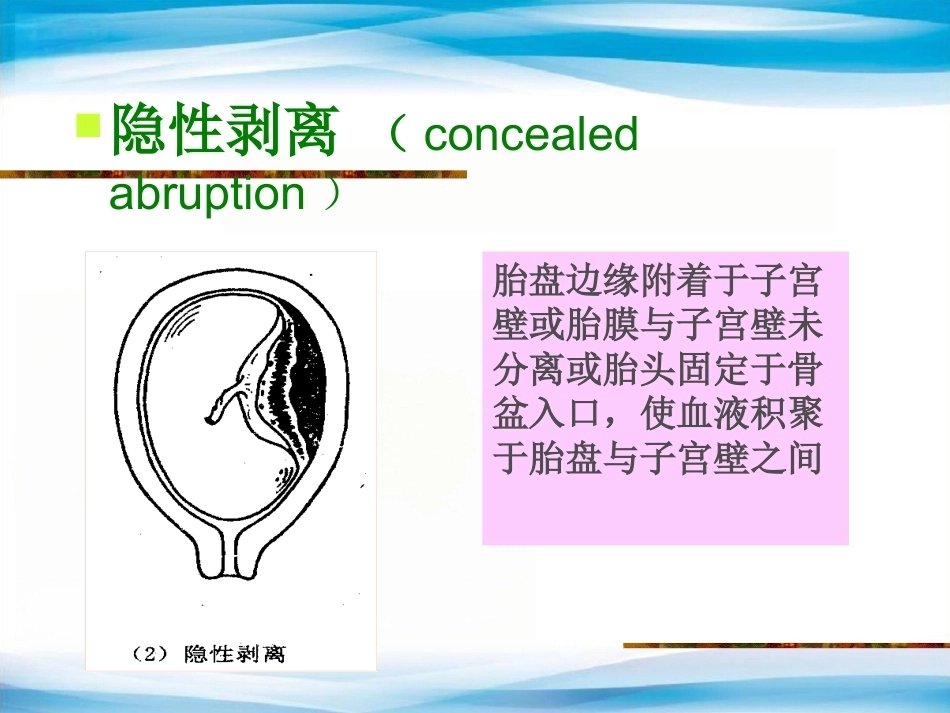 异常产褥妇产科学3_第10页